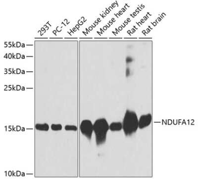 Western Blot: NDUFA12 Antibody [NBP2-94042] - Western blot analysis of extracts of various cell lines, using NDUFA12 antibody (NBP2-94042) at 1:3000 dilution. Secondary antibody: HRP Goat Anti-Rabbit IgG (H+L) at 1:10000 dilution. Lysates/proteins: 25ug per lane. Blocking buffer: 3% nonfat dry milk in TBST. Detection: ECL Basic Kit. Exposure time: 30s.